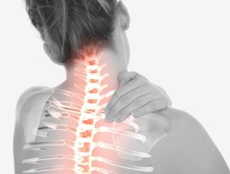 Osteocondrose da rexión cervical