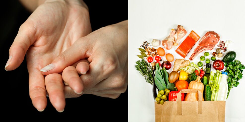 artrite gotosa das mans e alimentos para o seu tratamento